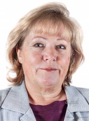 Mature woman with  fading scar three months after Mohs surgery for Basal Cell Carcinoma with nitrogen blisters on other cheeck from pre-cancer removal